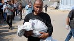 Potret Pilu Bayi di Gaza Meninggal karena Malnutrisi