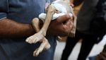 Potret Pilu Bayi di Gaza Meninggal karena Malnutrisi