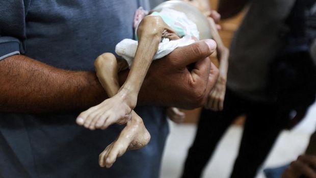 SENSITIVE MATERIAL. THIS IMAGE MAY OFFEND OR DISTURB A man carries the body of Palestinian baby Zainab Abu Haleeb, who died due to malnutrition, according to health officials, at Nasser Hospital in Khan Younis, southern Gaza Strip, July 26, 2025. REUTERS/Ramadan Abed TPX IMAGES OF THE DAY