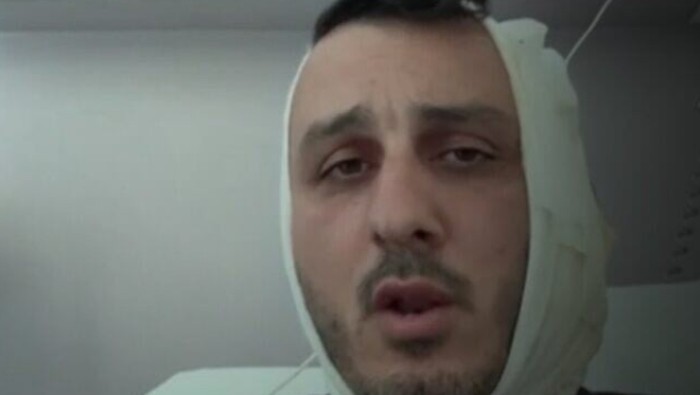 Turis Israel terluka digigit orang Suriah
