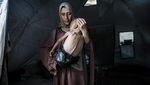 Malnutrisi Ancam Nyawa Anak-Anak di Gaza
