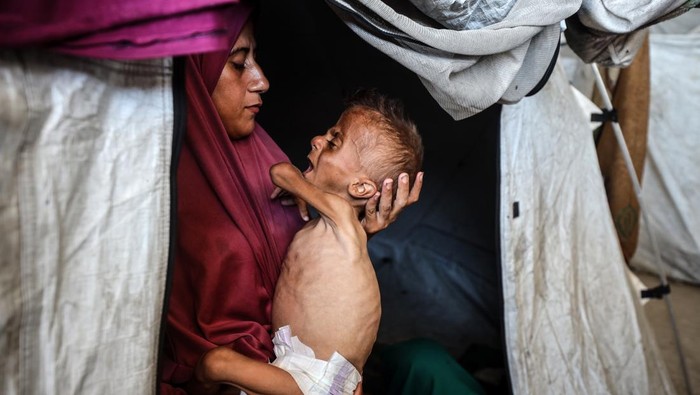 Hidaya, a 31-year-old Palestinian mother, sits with her sick 18-month-old son Mohammed al-Mutawaq, who also displays signs of malnutrition, inside their tent at the Al-Shati refugee camp in Gaza City, Palestine, on July 25, 2025. (Photo by Majdi Fathi/NurPhoto via Getty Images)