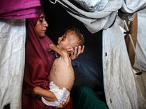 Miris! Kelaparan Membuat Anak-anak Gaza Tak Kuat Lagi Menangis