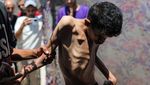 Malnutrisi Ancam Nyawa Anak-Anak di Gaza