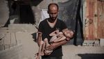 Malnutrisi Ancam Nyawa Anak-Anak di Gaza