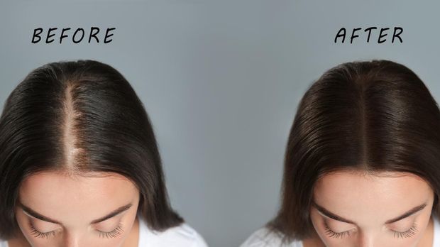 Pertumbuhan Rambut
