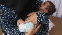 Najla Abu Aya menggendong putrinya yang berusia lima bulan, Rama, di Rumah Sakit Nasser, Khan Younis, Gaza Selatan, Rabu (24/7/2025). Dokter menyebut lengan sang bayi selebar ibu jarinya, menunjukkan malnutrisi akut yang tak tertangani. (REUTERS/Ramadan Abed)  