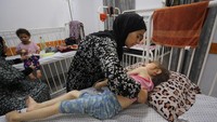 Jana, hanya seberat 11 kg, berjuang melawan edema dan kehilangan kemampuan dasar seperti berdiri dan berbicara. Kondisinya terus memburuk. Foto: REUTERS/Mahmoud Issa