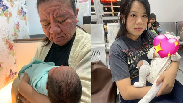 Wajah berubah saat hamil dan melahirkan