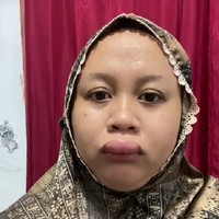 Bibirnya Bengkak Parah 3 Jam Sebelum Akad Nikah, Wanita Ini Viral di Medsos Bibirnya Bengkak Parah 3 Jam Sebelum Akad Nikah, Wanita Ini Viral di Medsos