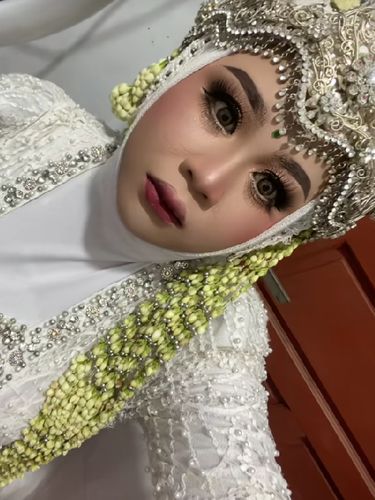 Pengantin wanita ini membagikan pengalaman yang tak terduga, bibirnya bengkak saat h-3 jam akad nikah.