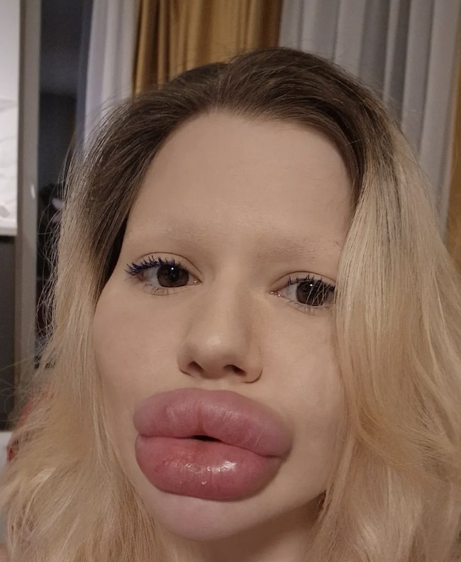 Meski menyadari bahaya tersebut, Andrea menyatakan tak akan berhenti. Ia tetap berkomitmen melanjutkan perubahan fisiknya. Foto: dok. Instagram @andrea88476