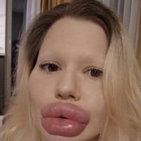 Meski menyadari bahaya tersebut, Andrea menyatakan tak akan berhenti. Ia tetap berkomitmen melanjutkan perubahan fisiknya. Foto: dok. Instagram @andrea88476