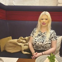 “Saya menyukai hal-hal yang berlebihan, seperti bibir besar, wajah penuh filler, riasan berat dan eksentrik,” ujar Andrea. “Kecantikan alami itu membosankan bagi saya, jadi saya memilih untuk mengubah penampilan saya secara radikal,” tambahnya.  Foto: dok. Instagram @andrea88476