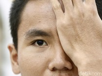 13,8 Juta Anak Ikut CKG Sekolah, Ini Masalah Kesehatan yang Banyak Ditemukan