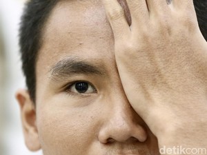 13,8 Juta Anak Ikut CKG Sekolah, Ini Masalah Kesehatan yang Banyak Ditemukan