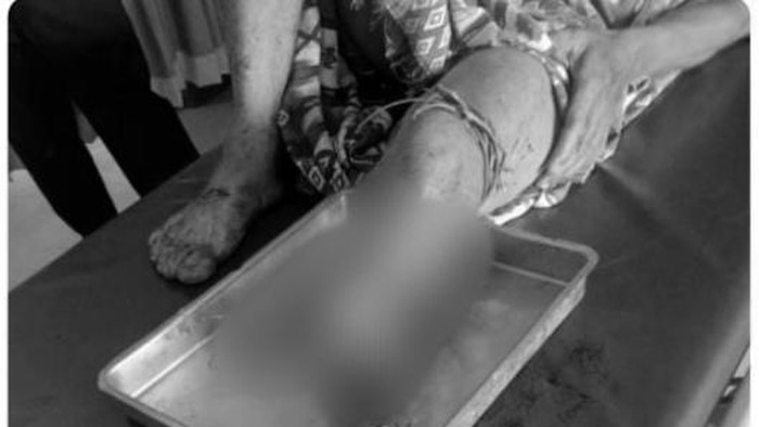Kaki warga Musi Rawas putus digigit buaya
