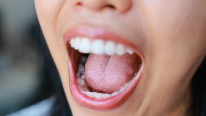 5 Tanda Masalah Kesehatan yang Bisa Diungkap dari Lidah