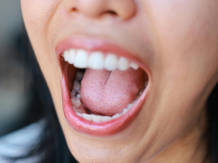 The woman show the picture of tongue problems, Illustration benign migratory glossitis on a brown paper, Behcets Disease