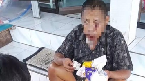 Tangkapan layar korban terserempet truk di Jalur 11, Karangasem saat ditolong warga sekitar, Selasa (5/8/2025).