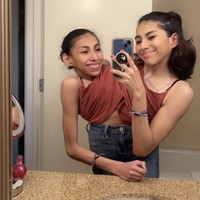 Carmen dan Lupita telah menjalani hidup bersama sejak lahir, termasuk menghadapi berbagai tantangan medis. Mereka belajar berjalan bersama setelah menjalani terapi fisik selama bertahun-tahun. Foto: dok. Instagram @it.be.dan @carmen_soland