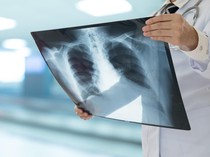 Aneh Banget, Dokter di India Keluarkan Lampu LED dari Paru-paru Bocah 3 Tahun