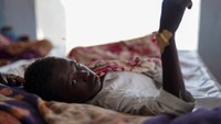 Seorang pasien kolera berbaring di tempat tidur klinik darurat yang dijalankan PBB di Tawila, Darfur Utara, Sudan, Selasa (5/8/2025). REUTERS/Mohammed Jamal