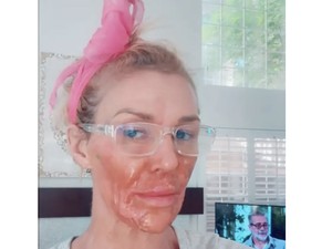 Apa yang Terjadi dengan Wajah Bintang Reality Show Ini? Kondisinya Makin Parah
