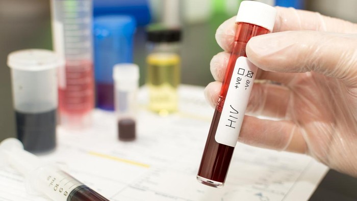 Holding a test tube with blood in it. Handwritten label with HIV on it with the negative tick box crossed.