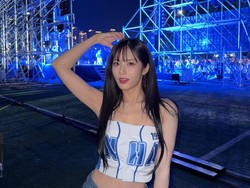 Idol KPop Wanita Ini Buka-bukaan Soal Botox Hingga Transplantasi Rambut