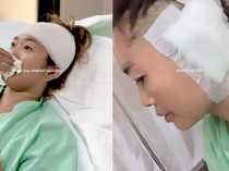 Awal Mula Wanita Malang Jalani Operasi gegara Telinganya Terlalu Bersih