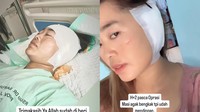 Viral Curhat Wanita Malang Operasi Telinga gegara Keseringan Pakai Cotton Bud