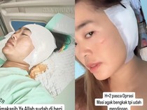 Viral Curhat Wanita Malang Operasi Telinga gegara Keseringan Pakai Cotton Bud