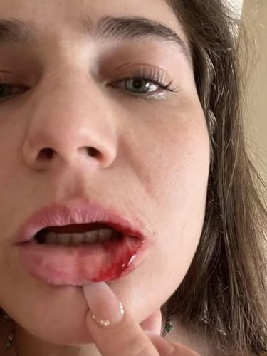 Model diikat di tangga