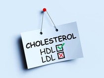 Sederet Cara Menurunkan Kolesterol Secara Alami, Termasuk Kurangi Makanan Ini