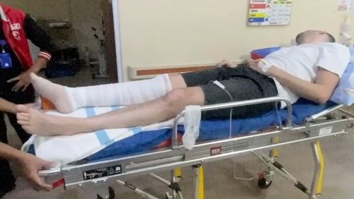 WN Mesir, Ahmed Samy Niazy Elgharably digigit ular berbisa saat menginap di Novotel Hotel, Kuta Lombok. (Bayu Perdana).