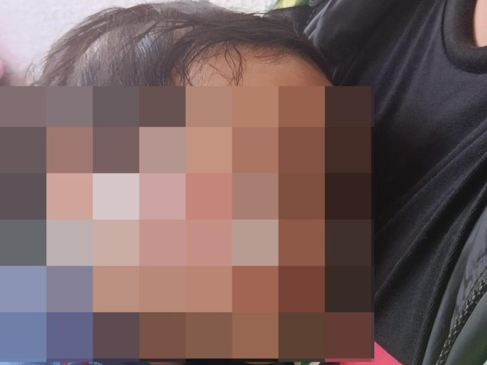 Anak 1 tahun penuh luka sepulang dari daycare di Surabaya