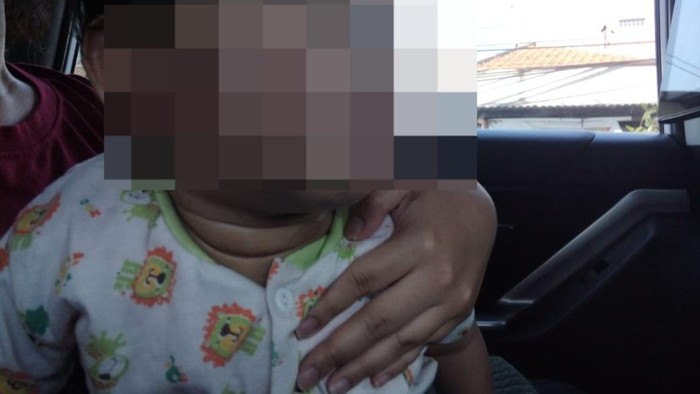 Anak 1 tahun penuh luka sepulang dari daycare di Surabaya