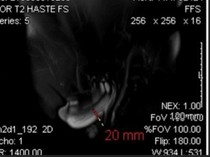 Krek! Dokter Tangani Kasus Mr P Patah saat Bercinta, Berujung Jalani Operasi