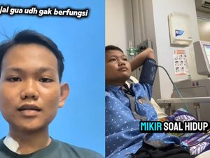 Kondisi Pemuda Makassar Idap Gagal Ginjal Sejak Umur 15, Sudah Cuci Darah 300 Kali