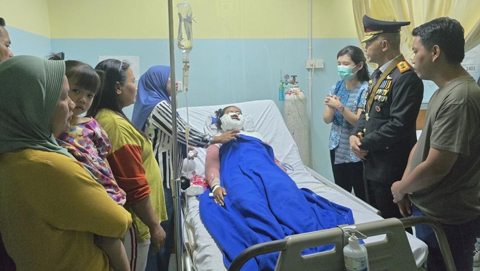 Kapolda Babel Irjen Hendro Pandowo menjenguk IRT yang menjadi korban penyiraman air keras.
