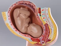 China Rancang Robot Rahim Buatan untuk Bantu Kehamilan
