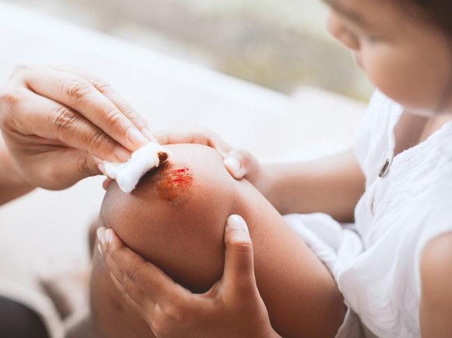 Antiseptik Ini Terbukti Efektif dalam Menangani Luka Terbuka, Ini Kata Dokter