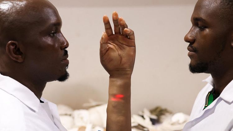Keren, Lengan Bionik dari Nigeria Seperti Kulit Manusia