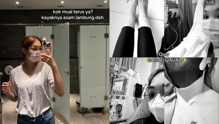 Wanita di Bali Kena Gagal Ginjal Stadium 5 di Usia 28 Tahun, Ini Pemicunya