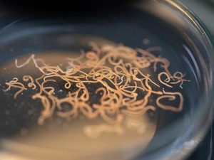 Malah Keluar Cacing dari Hidung dan Mulut? Pakar Beberkan Efek Jenis-jenis Obat Cacing