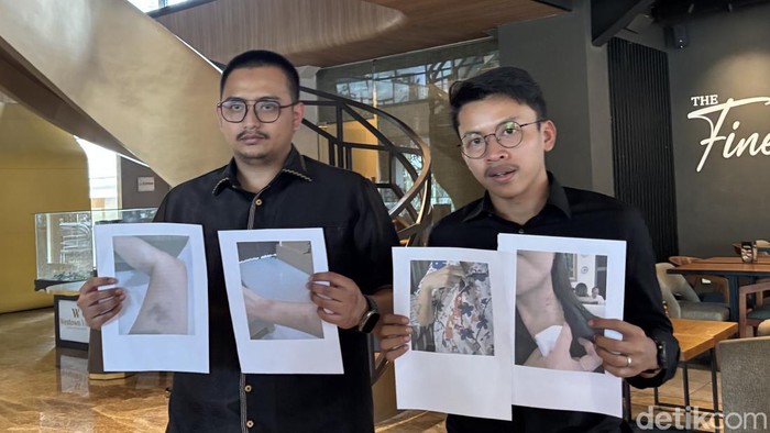 Kuasa hukum korban KDRT di Surabaya, Andrian Dimas Prakoso.