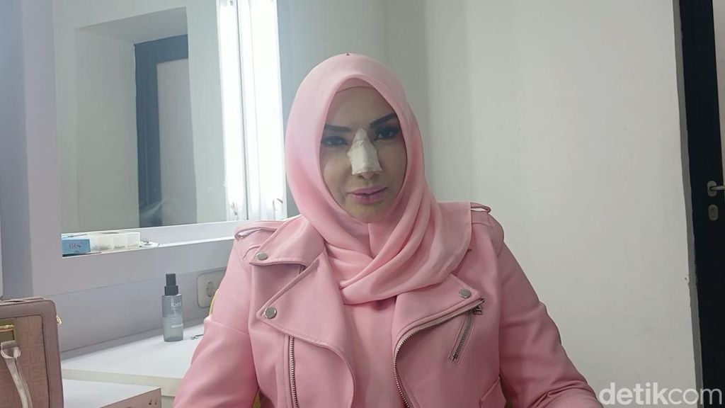 Alasan Roro Fitria Jalani Operasi Sinus Sekaligus Rhinoplasty