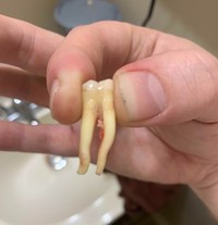 Beberapa orang berikut memiliki bagian tubuh yang unik, tak biasa. Adakah kondisi yang juga kamu miliki?