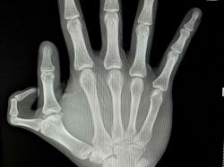 Bagian Unik dari Tubuh Manusia, Benar-benar Kuasa Tuhan